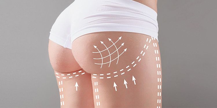 30 Günlük Selülit ve Varis Karşıtı Plan - Tight Tonic