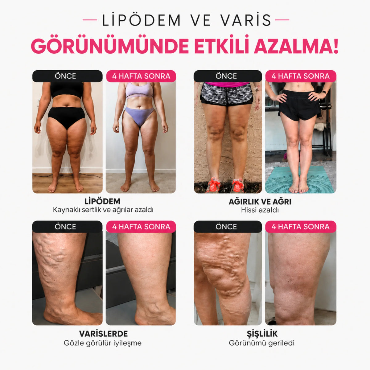 3'lü Etki Taytı Lipödem, Selülit, Varis