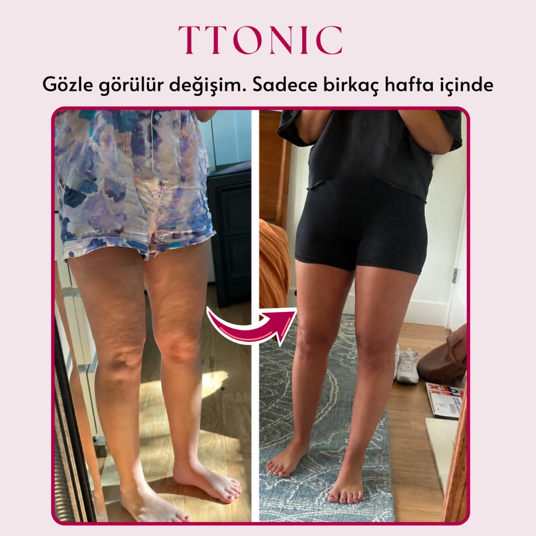 3'lü Etki Taytı Lipödem, Selülit, Varis