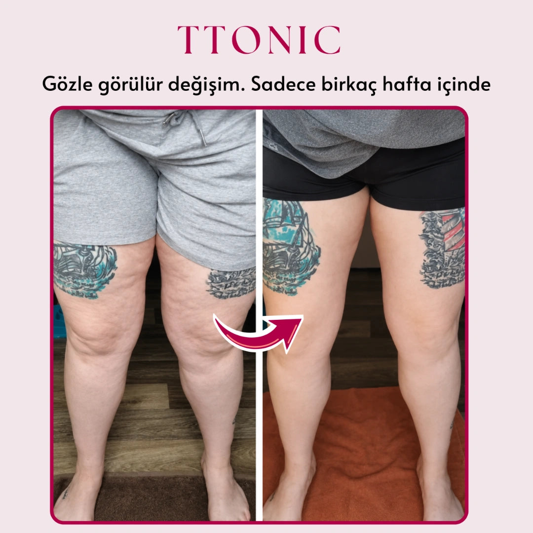 3'lü Etki Taytı Lipödem, Selülit, Varis