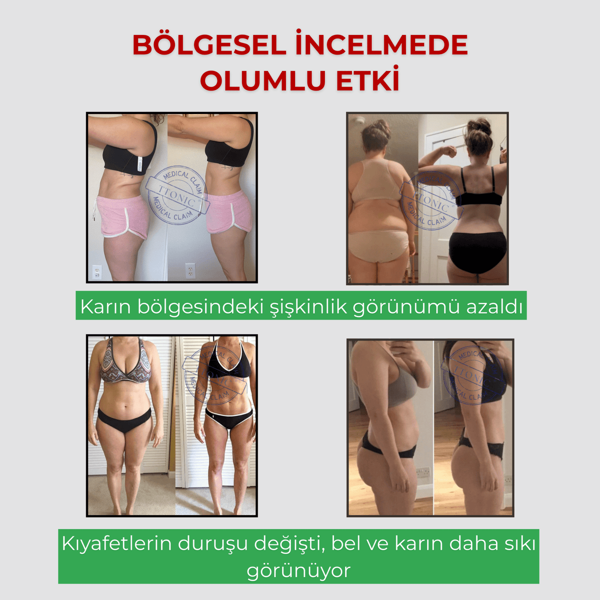 Yağ Yakıcı Şekillendirici Korse - Tight Tonic